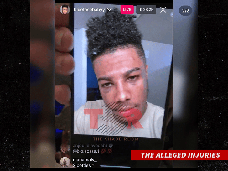 blueface the alleged injuries