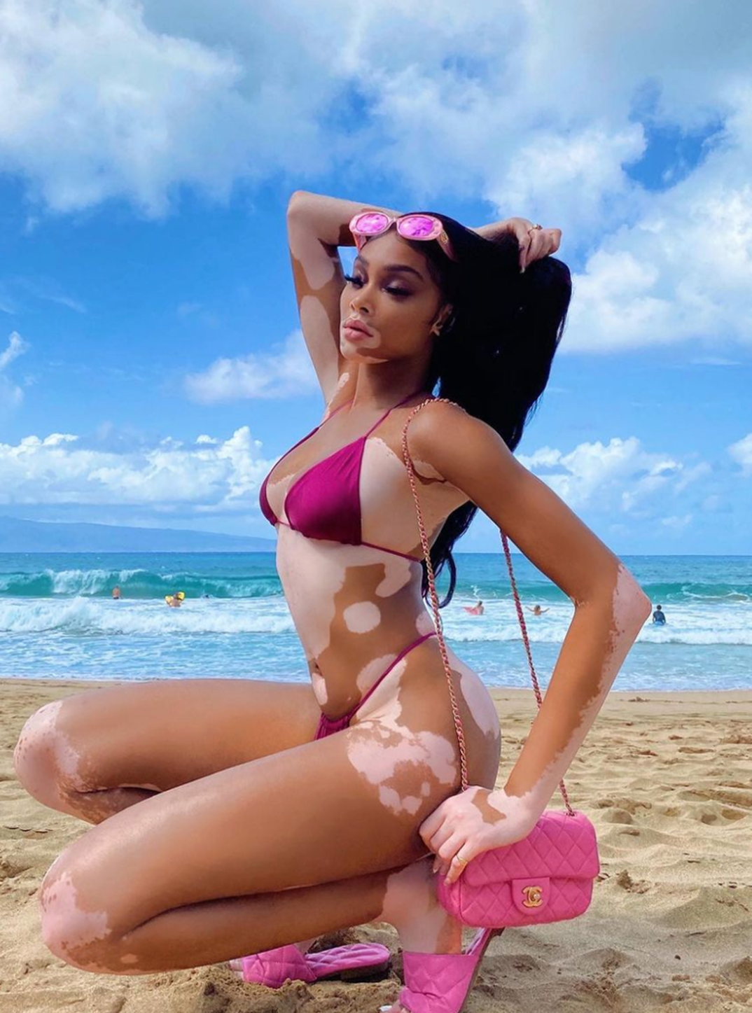 winnie-harlow-hot-bday-photos4