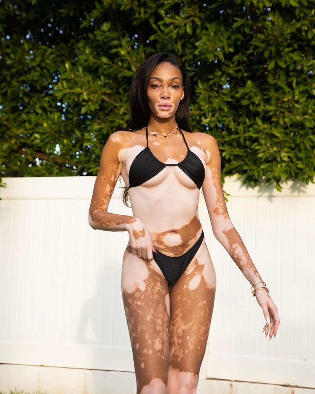 Winnie Harlow