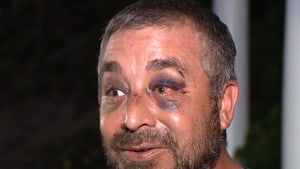 Youth Soccer Coach Claims Dad Brutally Attacked Him During Scrimmage