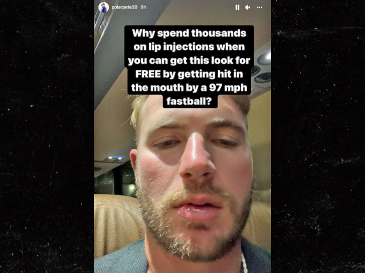 Look: Mets Star Pete Alonso Hit In Face By 95-MPH Fastball - The Spun:  What's Trending In The Sports World Today