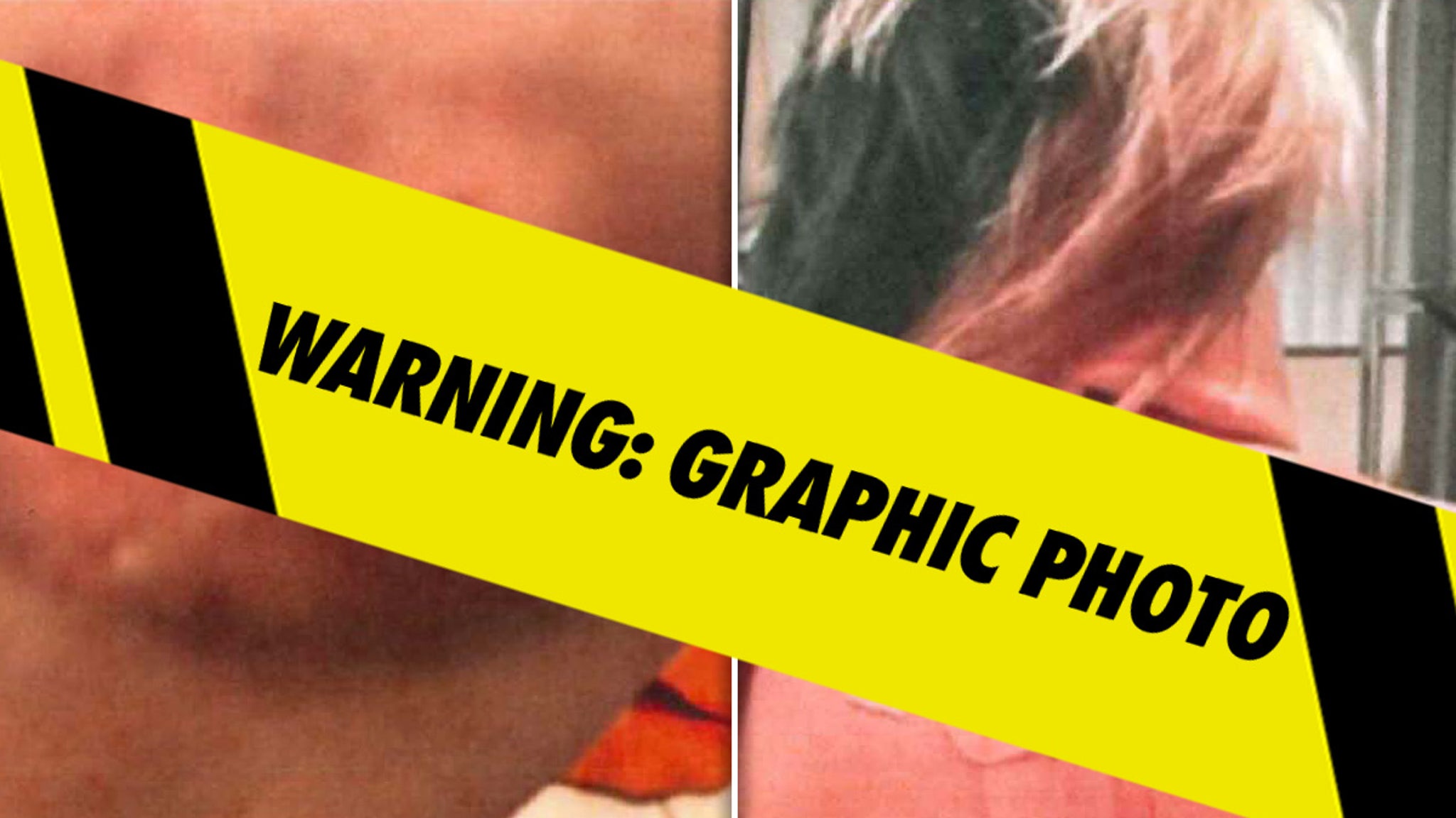 Bryana Bongolan's Alleged Injury Photos From Diddy Balcony Incident Filed As Evidence