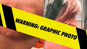 bryana injury p diddy launch exhibit