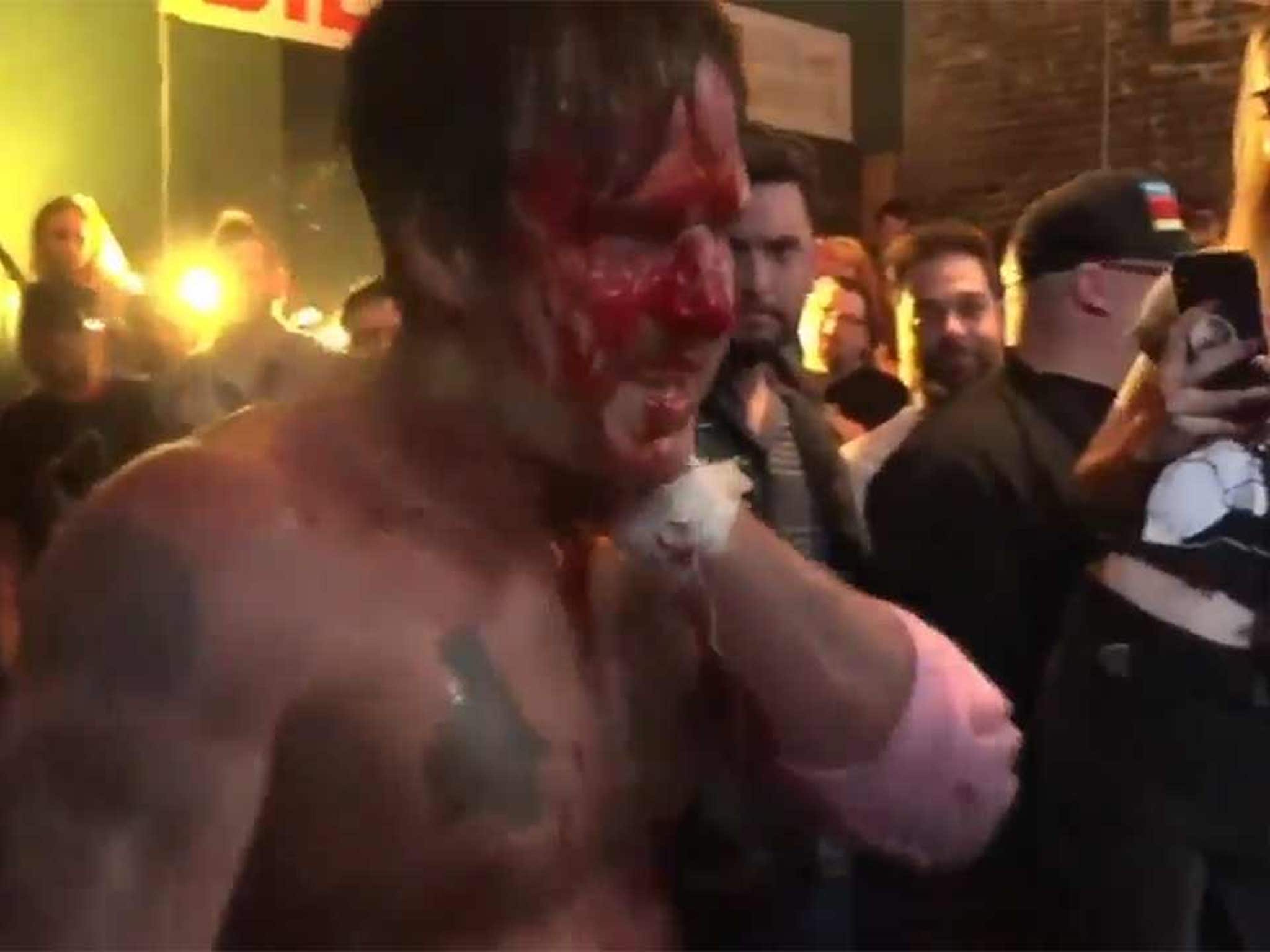 David Arquette Loses in Brutal and Bloody Wrestling Deathmatch