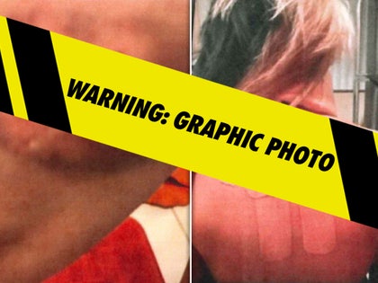 bryana injury p diddy launch exhibit