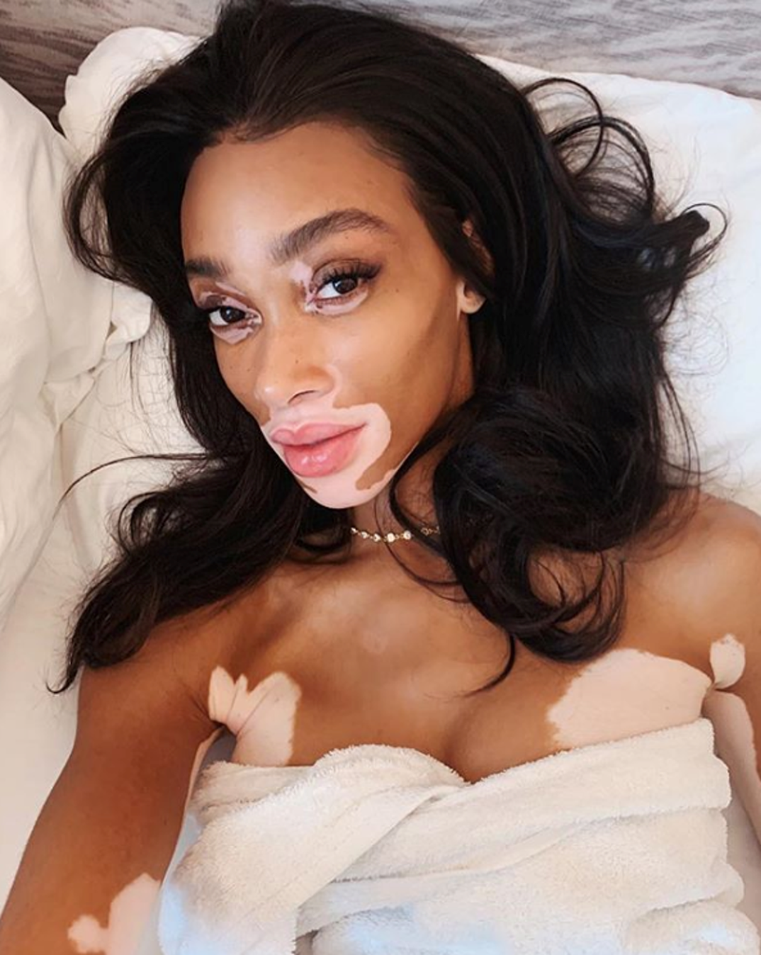 Winnie Harlow