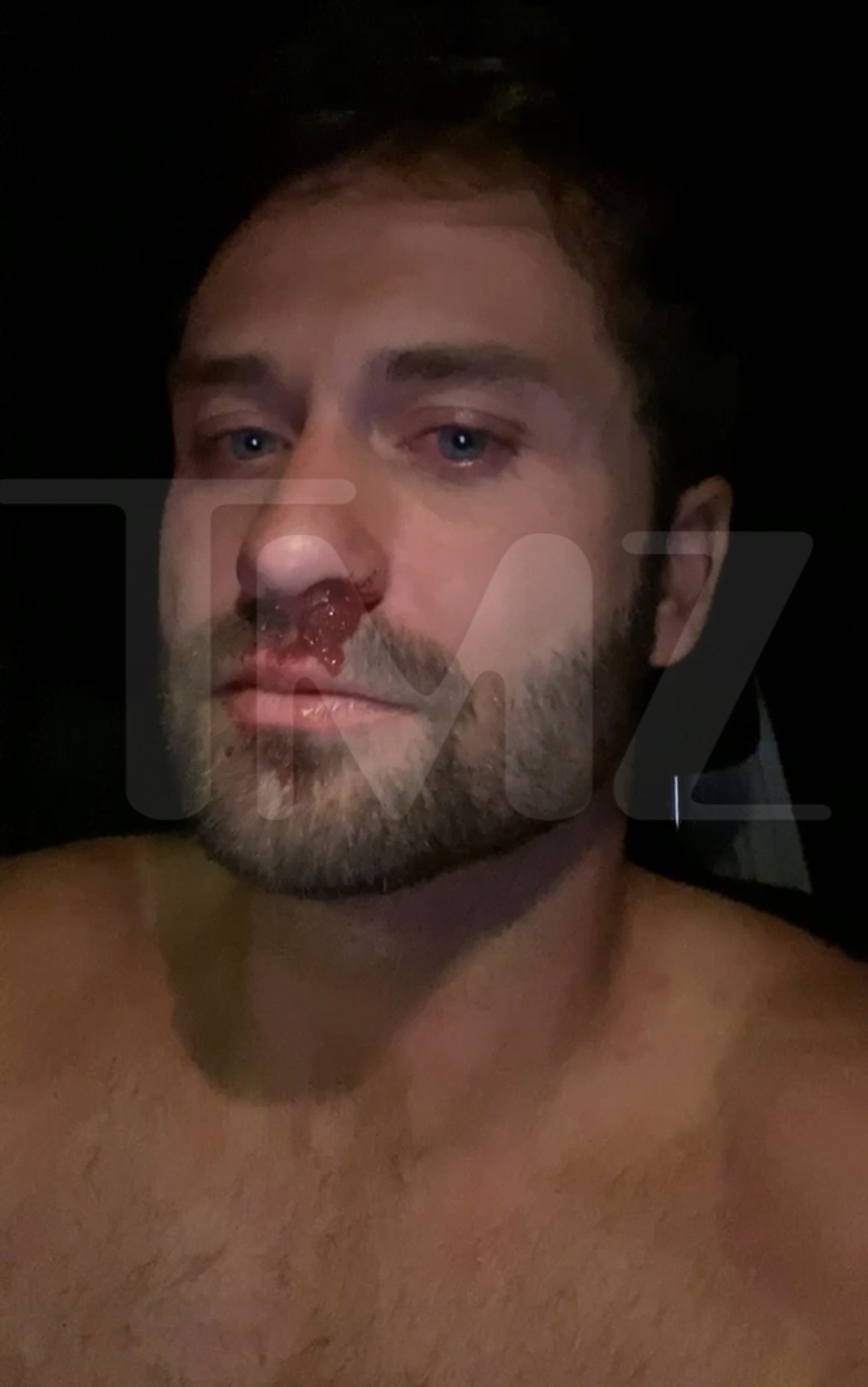 Dakota Mortensen Alleged Injuries 3