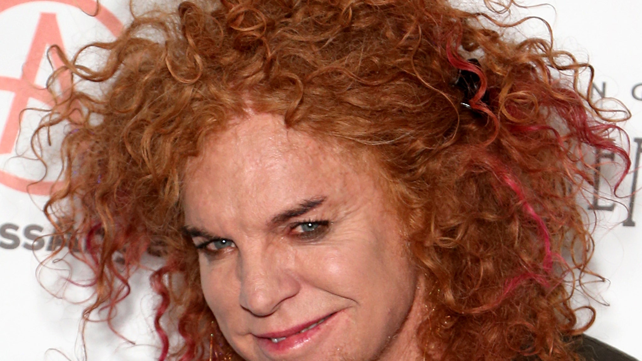 Carrot Top Is Doing Better, Released From Hospital