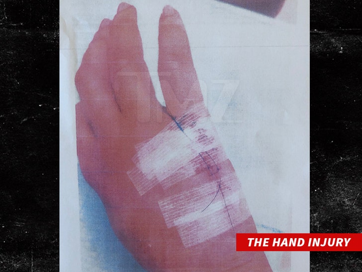 0830-ashley-jones-hand-injury-tmz-wm