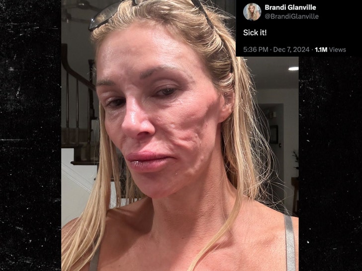 rosto de brandi glanville