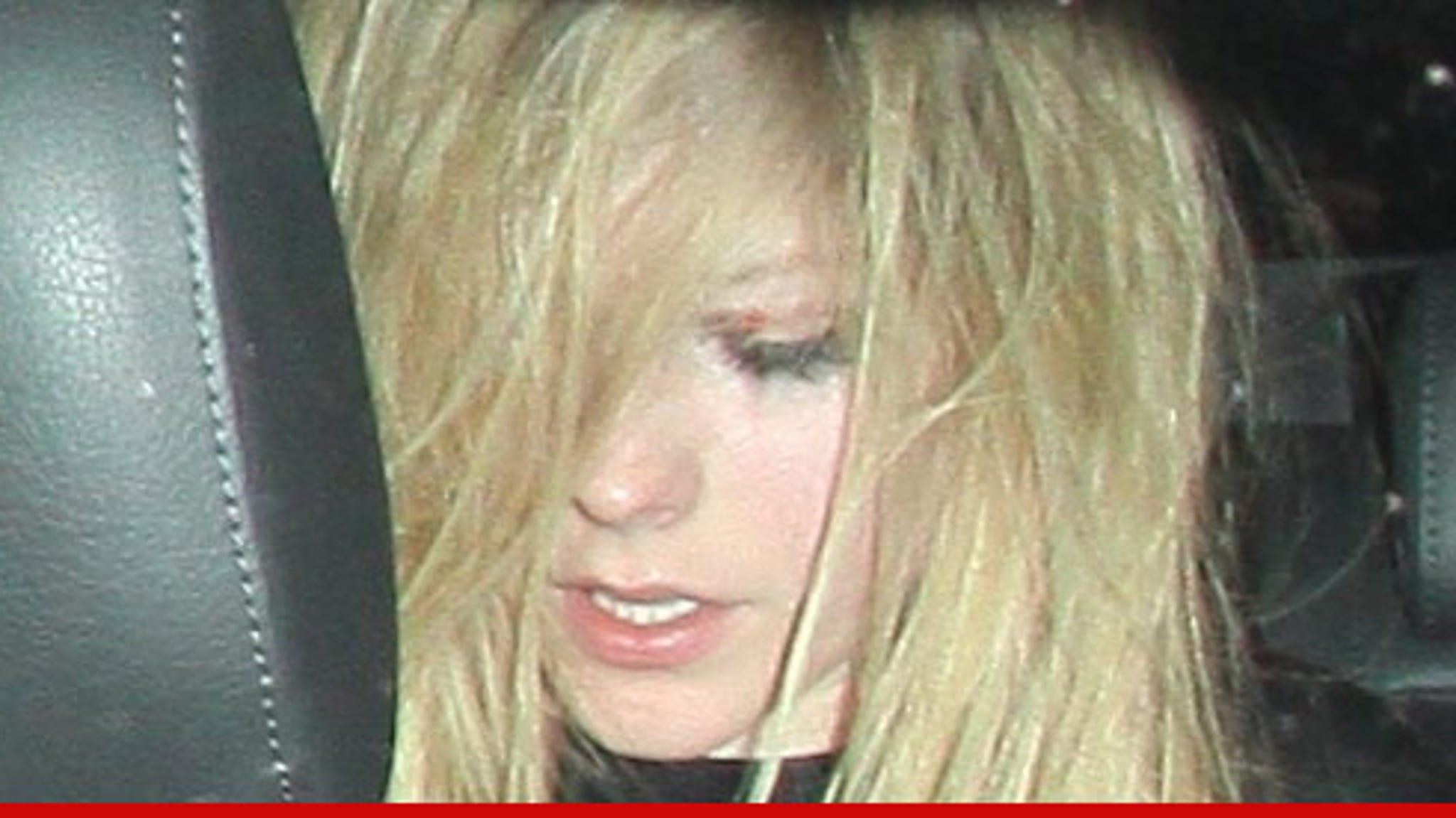 Avril Lavigne Worse For Wear After Fight 