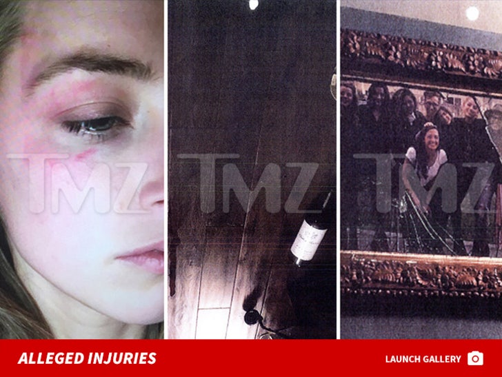 Amber Heard -- The Alleged Injuries