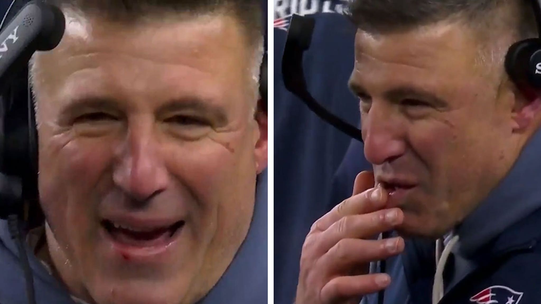 Mike Vrabel Bloodied After Taking Hit From Player During Patriots' Playoff Win