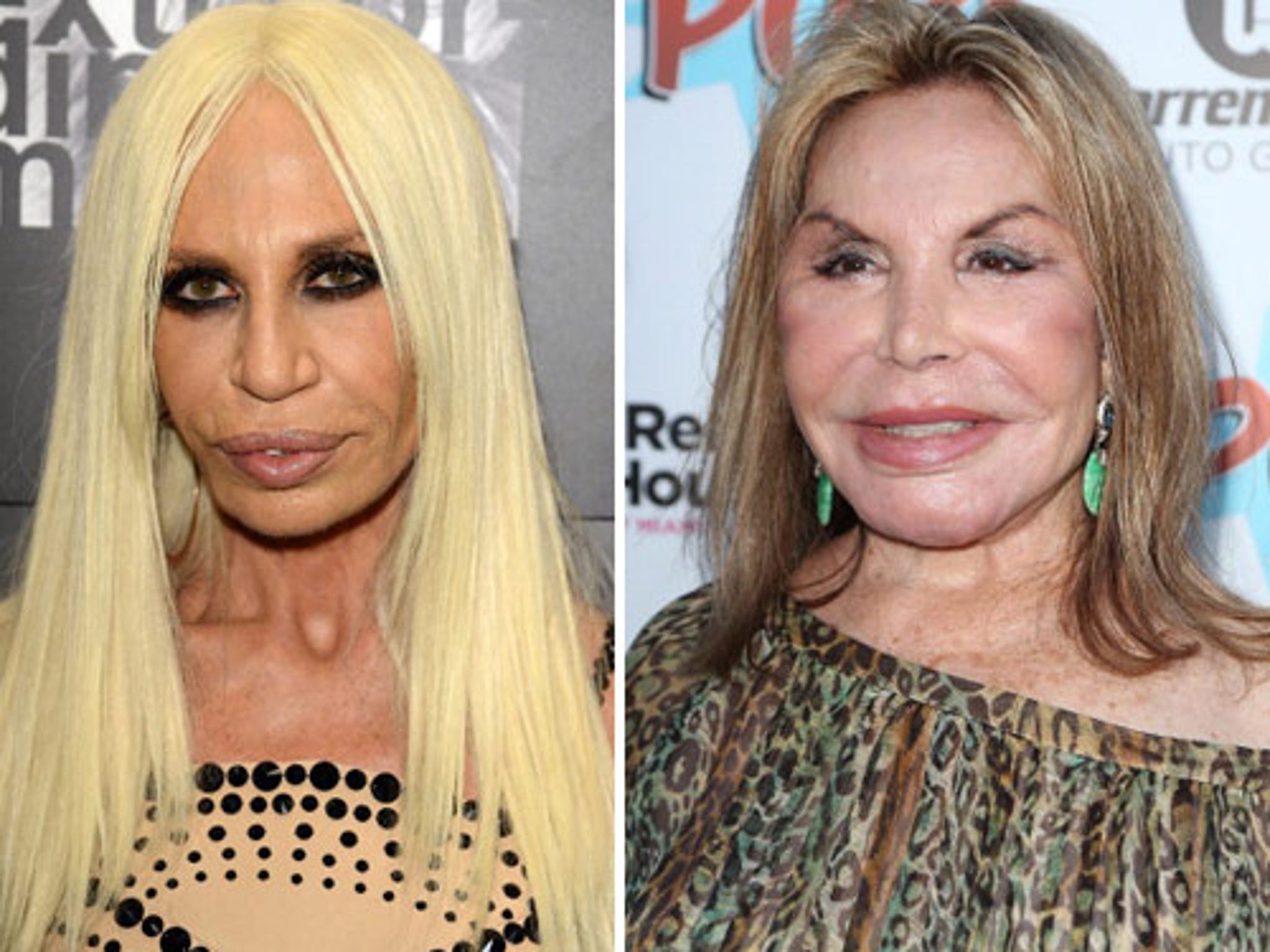 Donatella Versace Named 'Fashion Icon' By The 2017 Fashion Awards,  donatella versace antes e depois 