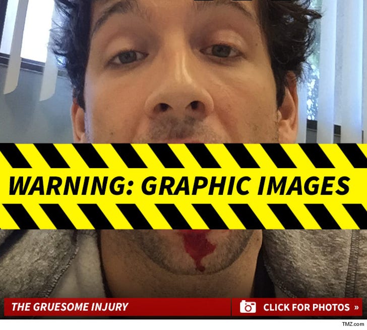 Rick Glassman's Bloody Tongue Injury