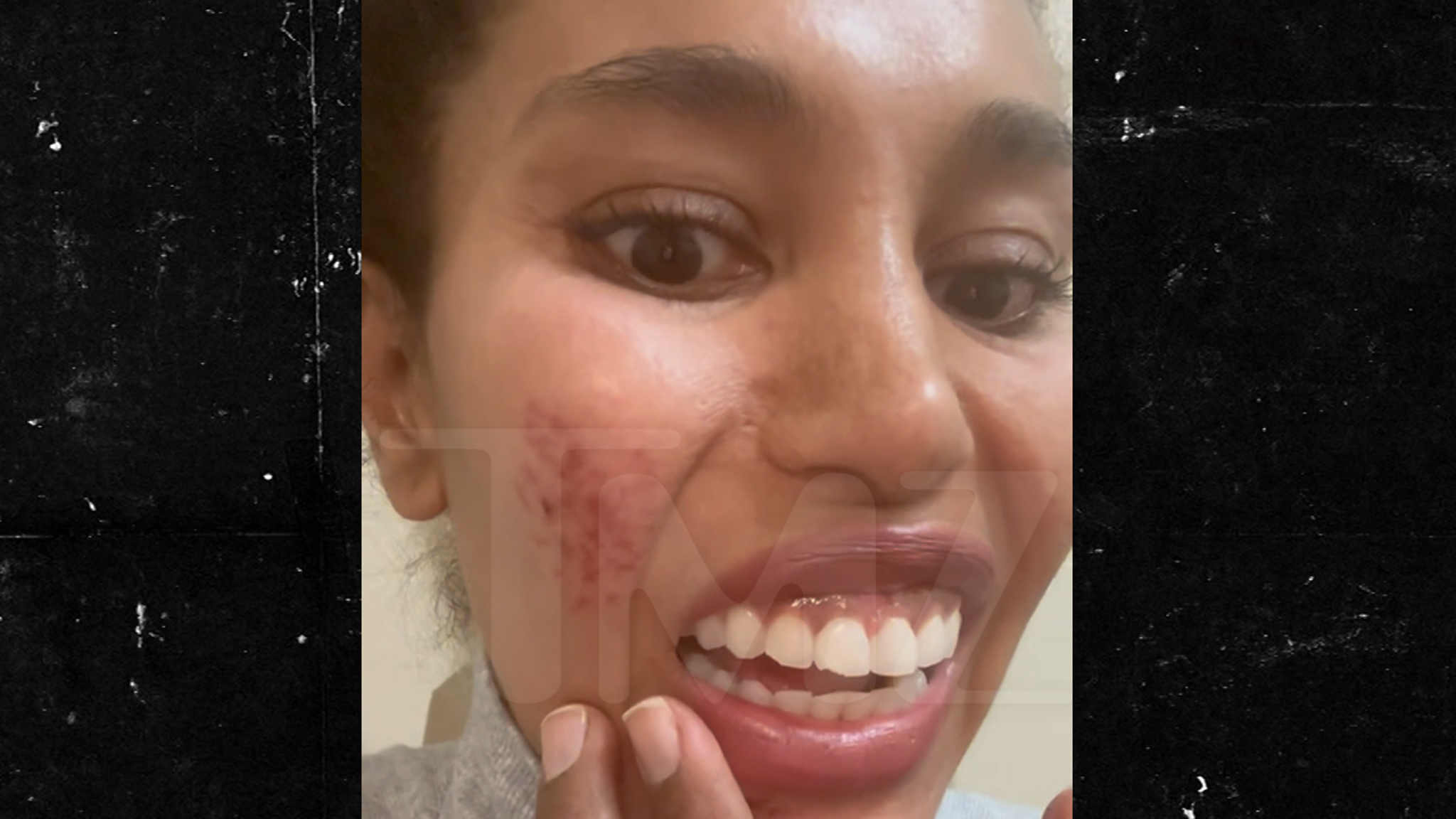 V. Stiviano Says She Blacked Out Leaving Hotel, Woke Up in Middle of Street