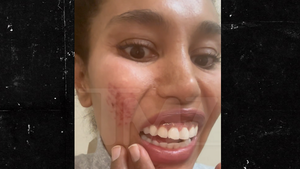 011326 v stiviano primary