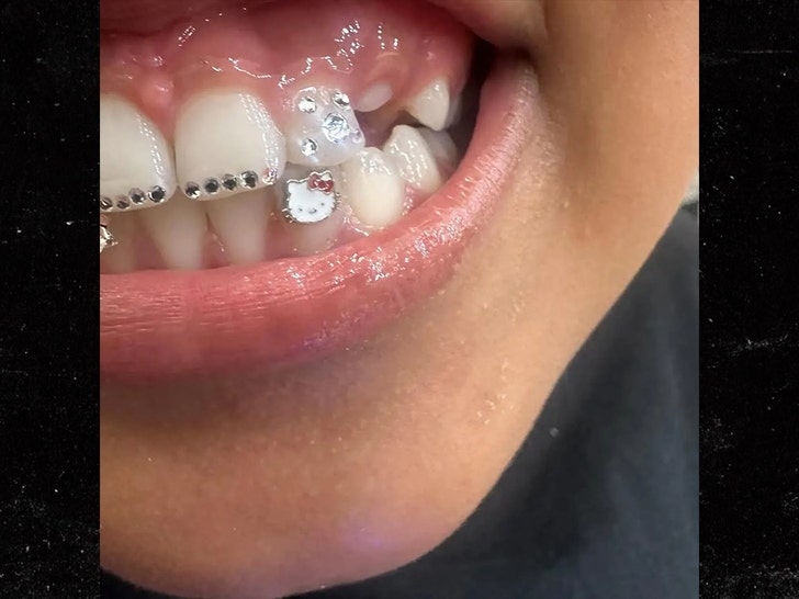 kim karadshian son saint bloody teeth insta 2
