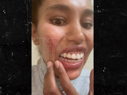 011326 v stiviano primary