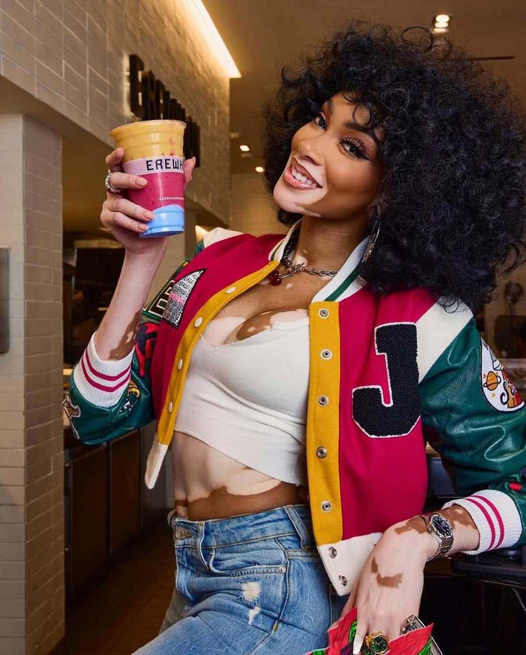 Winnie Harlow