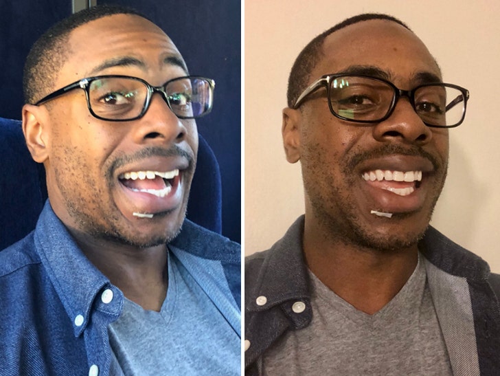 Curtis Granderson Gets Chipped Tooth Fixed Before Game Check Out :: 1019-curtis-granderson-tooth-twitter-1