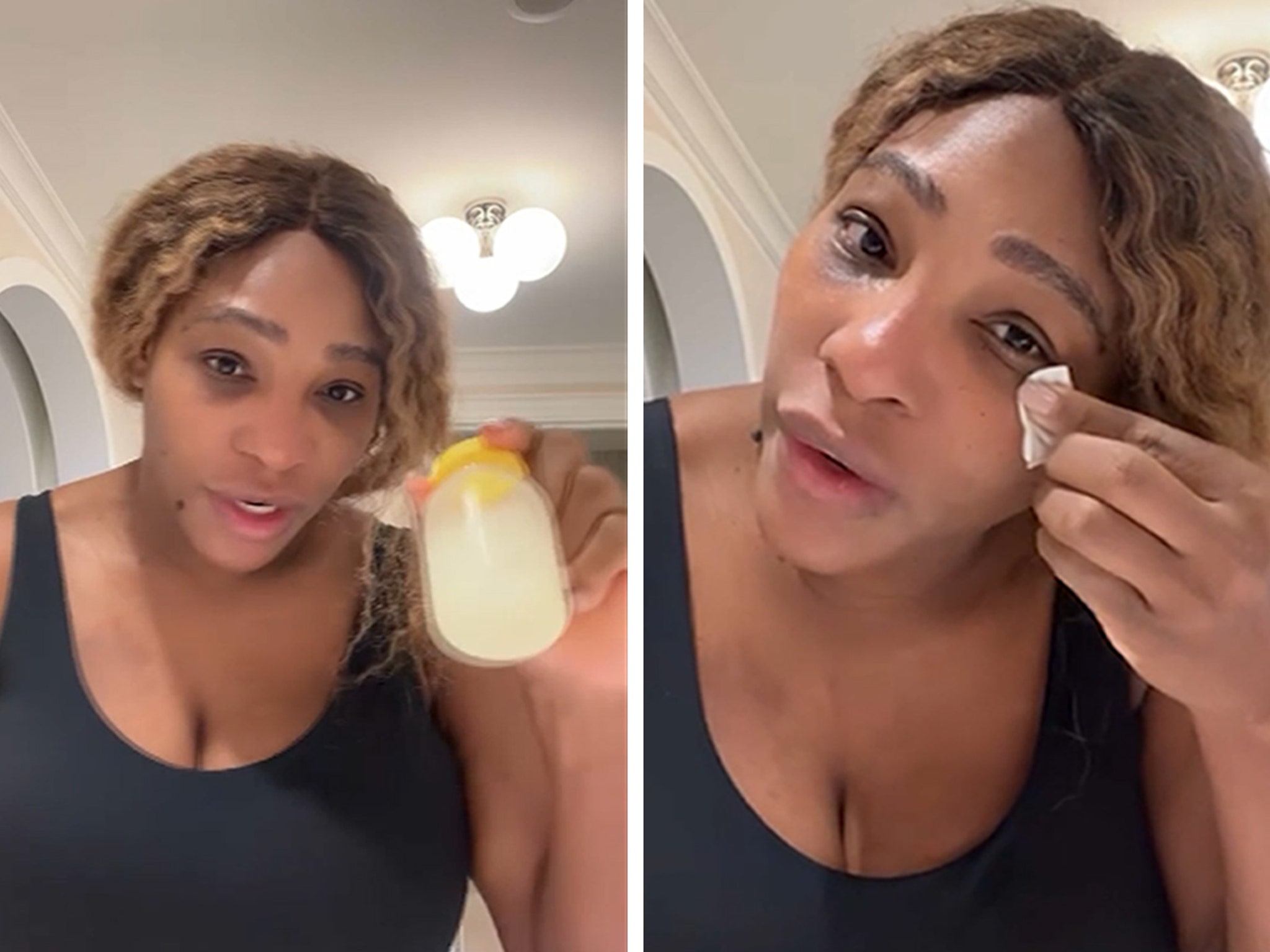 Serena Williams Says Her Breast Milk Helped Heal Her Facial Sunburns