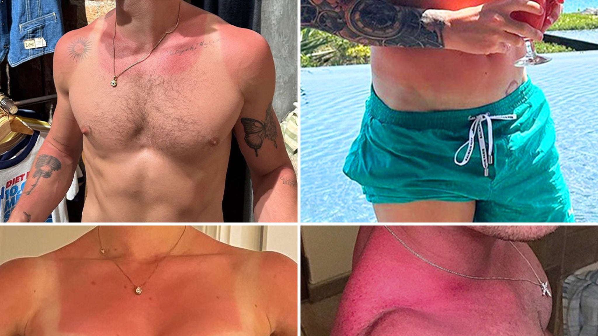 Celebrity Sunburns Guess Who Can t Handle The Vitamin D 