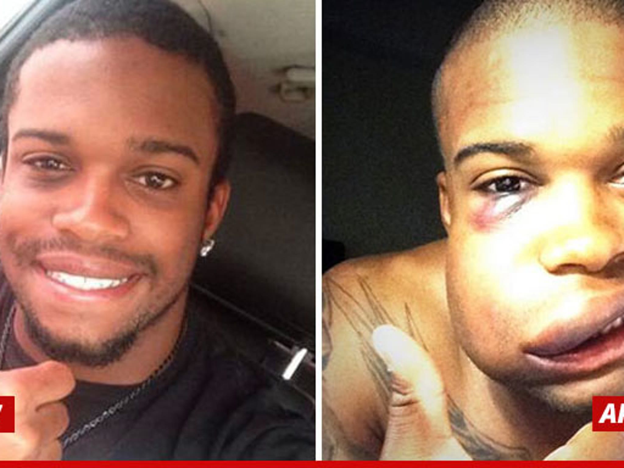 Scary photo: Delino DeShields Jr. suffers fractured cheek bone after taking  pitch to face - NBC Sports