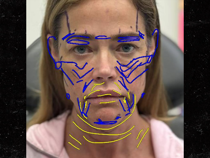 denise richards facelift sub insta