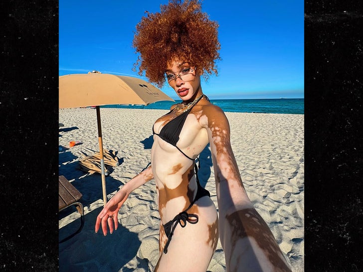 0717-Winnie-Harlow-Hot-Shot-Son-Tlelen-2