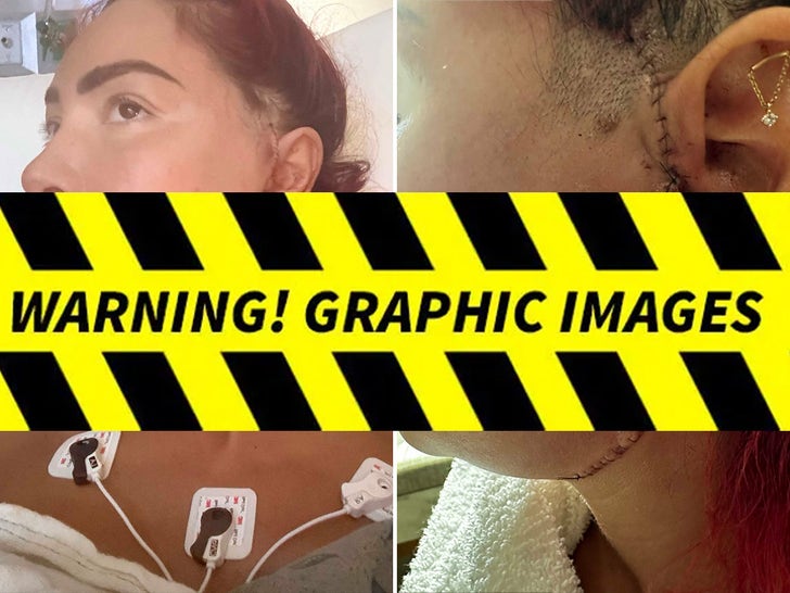 Farrah Abraham Post-Op Surgery Photos