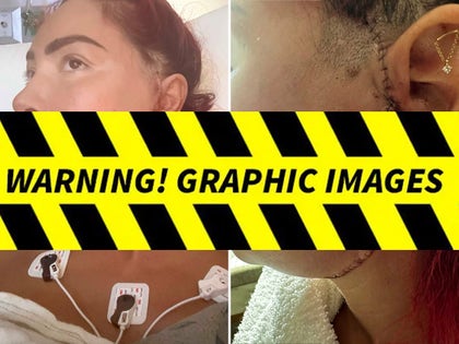 099-Farrah-Abraham-Post-Op-PRIMARY