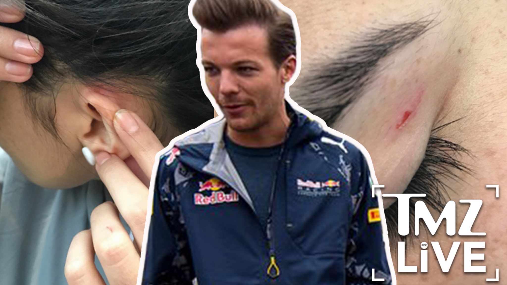 VIDEO] Louis Tomlinson Hit A Girl? — She Says 'He Gave Me A