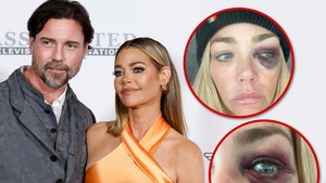 denise ricahrds and Aaron Phypers alleged injuries lawsuit 4