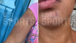 1001-Woman-Victim-Injuries-Quinshon-Judkins-PRIMARY