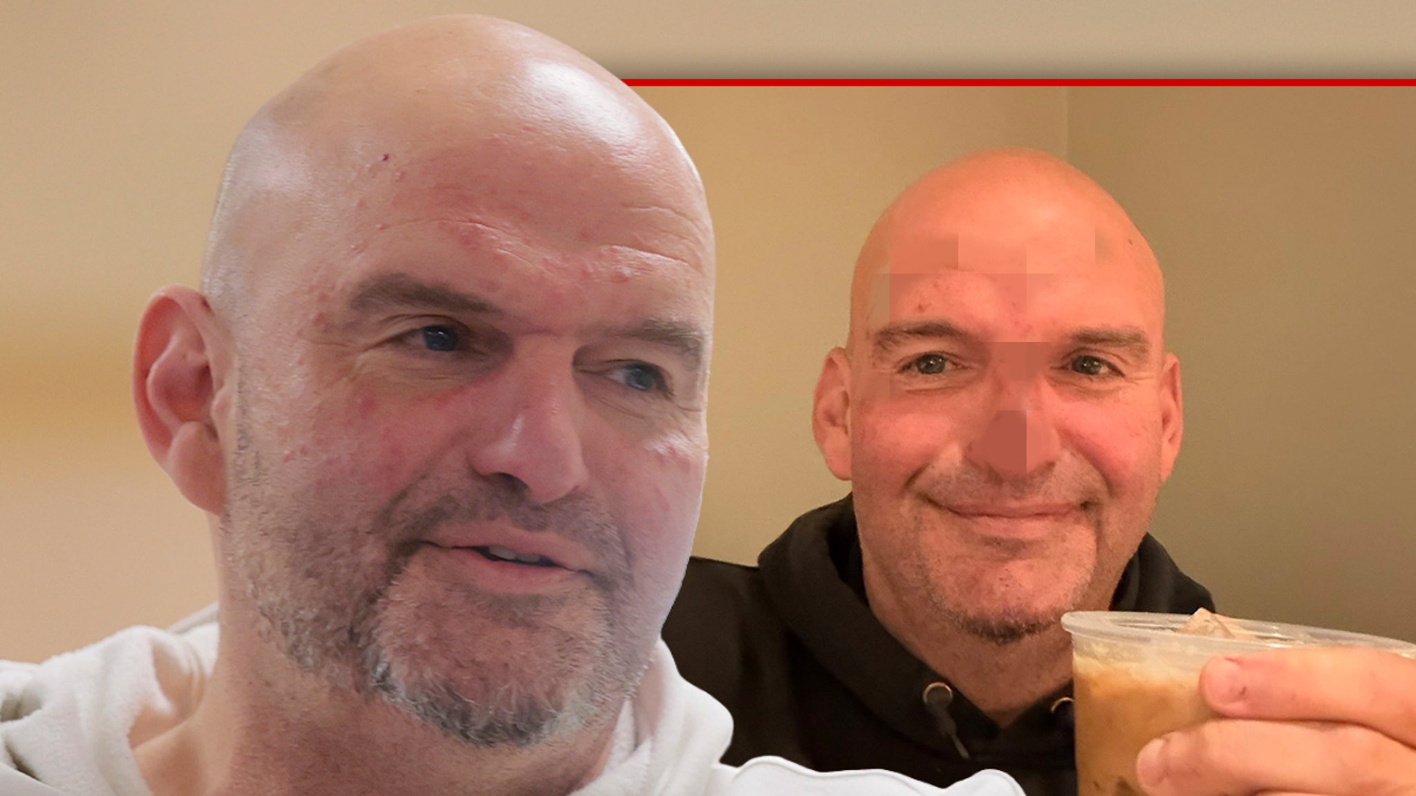 Senator John Fetterman Says He Needed 20 Stitches, Shares Photo of Banged Up Face Senator John Fetterman Says He Needed 20 Stitches, Shares Photo of Banged Up Face