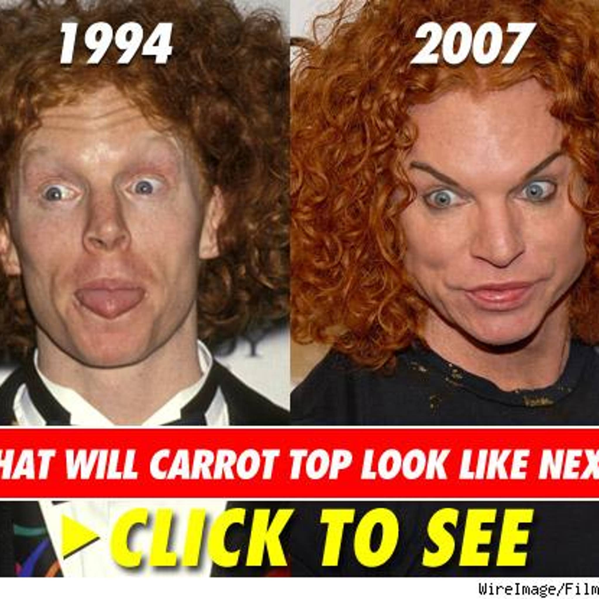 Carrot Top 2022 Before And After Carrot Top 2022 Before And After