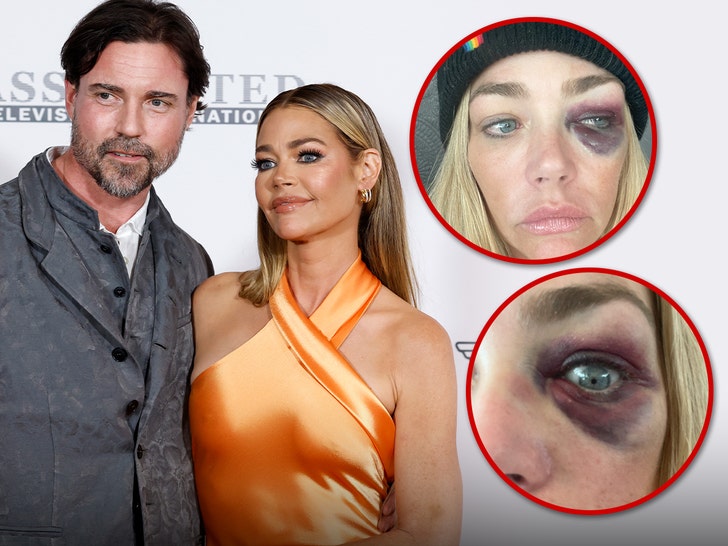denise ricahrds and Aaron Phypers alleged injuries lawsuit 4