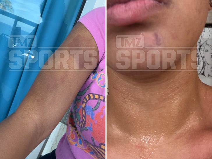 Woman Victim Injuries From Quinshon Judkins
