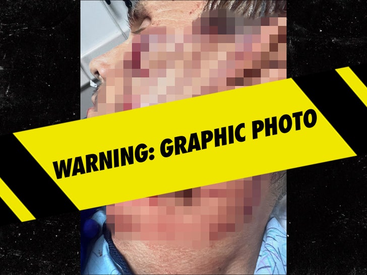 Jamie Mitchell's Injury