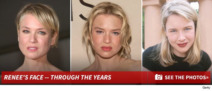 Renee Zellweger's Face -- Through The Years