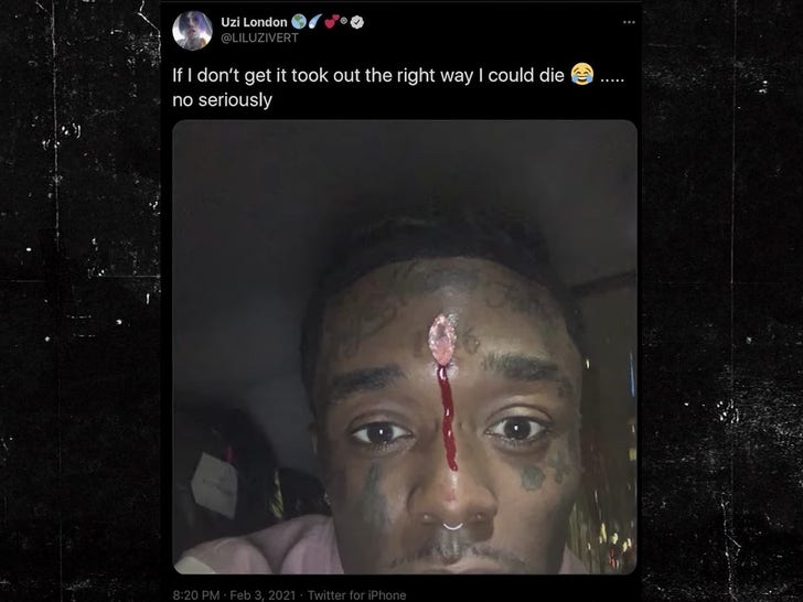 Lil Uzi Vert Says Forehead Diamond Got Ripped Out By Fans During