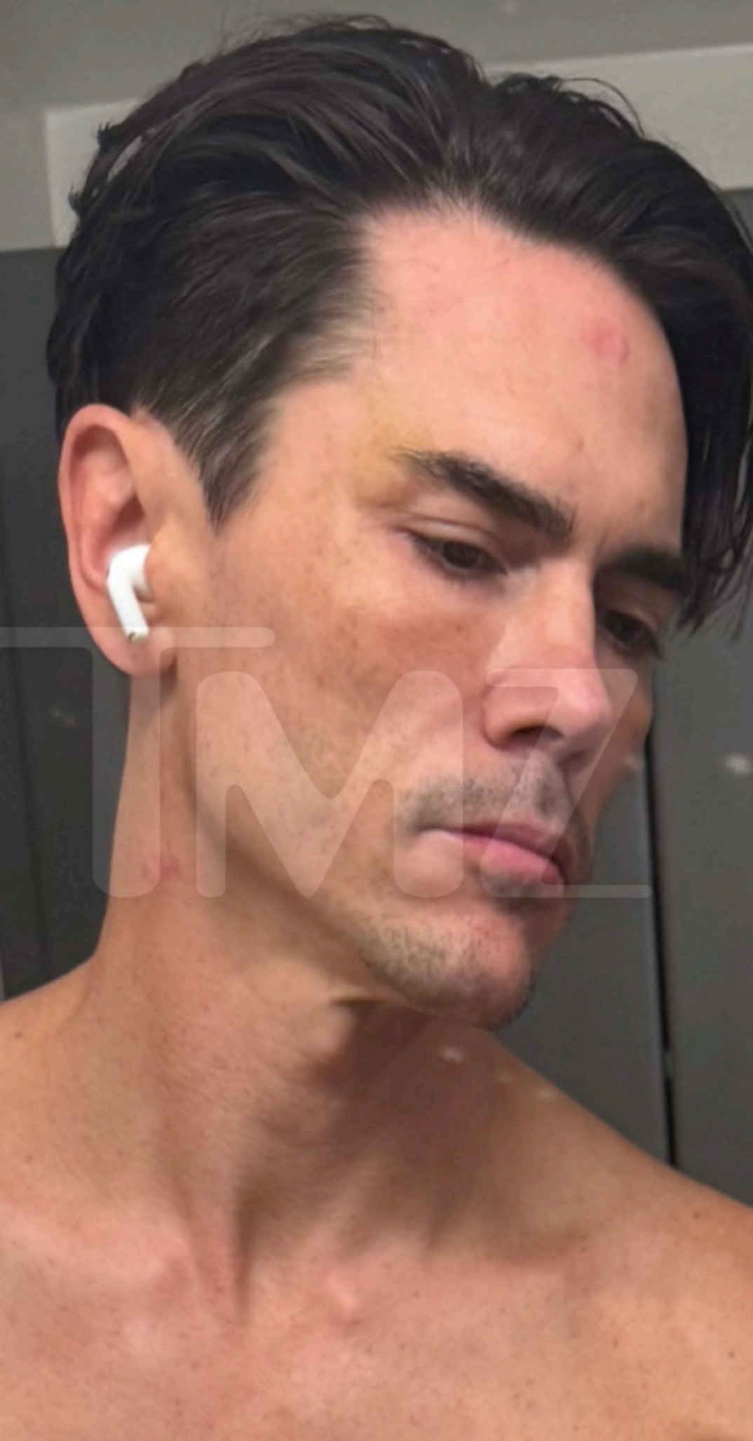 Tom Sandoval Injuries 3