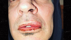 Tommy Lee's Son, Brandon, Says Dad Was Drunk, Punched Him in Self-Defense (UPDATE)