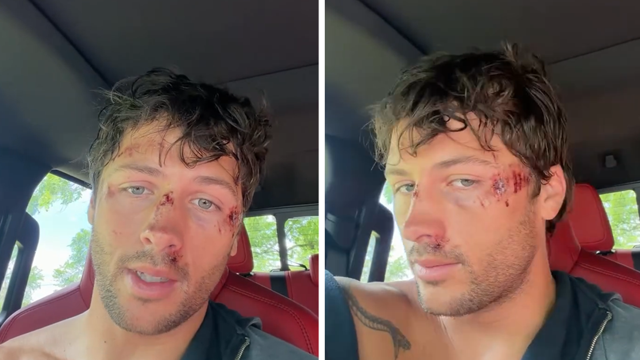 'Traitors' Winner Rob Rausch Banged Up Bad After Bike Slams Into Dog