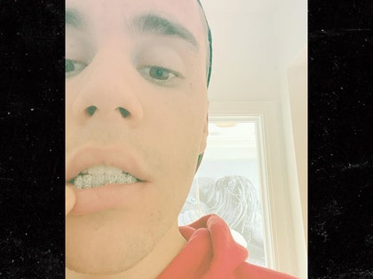 0925-justin-bieber-grill-instagram-01