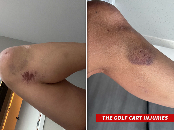 Jeannie Mai The Golf Cart Injuries