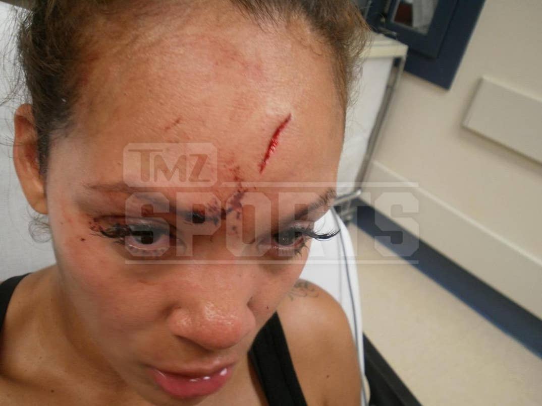 Evelyn Lozada's Head Injury, image size:1074x806