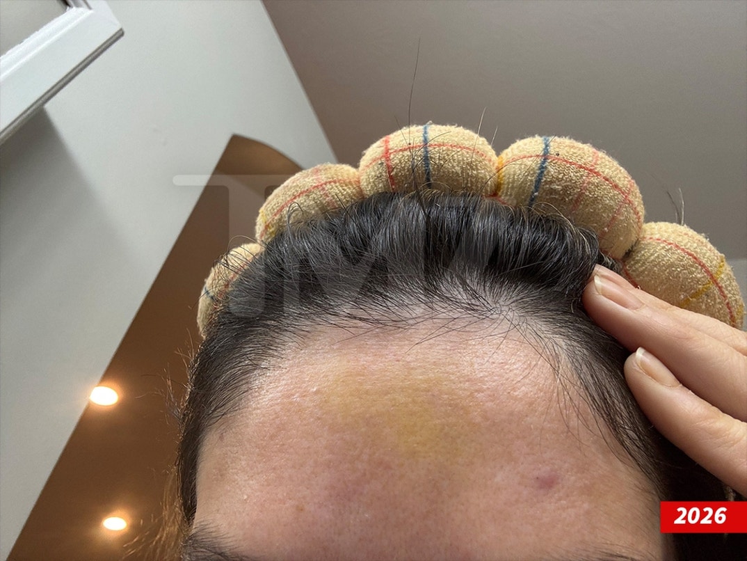 Dakota-Mortensen-Alleged-Injuries-Swipe- 2