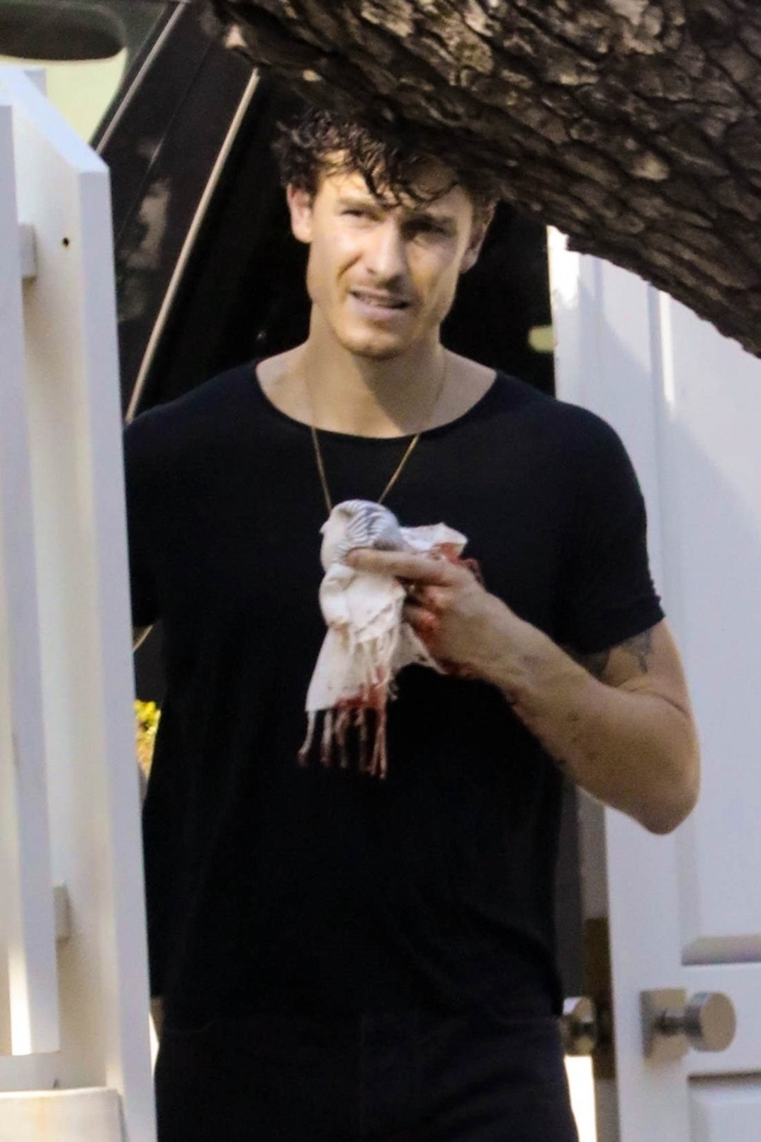 Shawn Mendes Bloody Finger 2